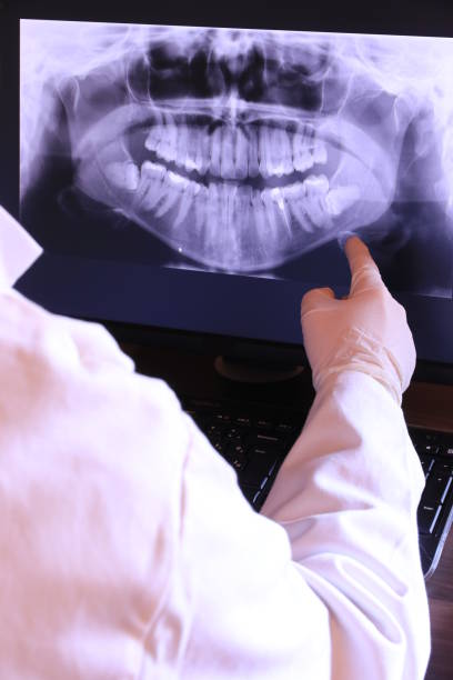 Best Emergency Dentist for Knocked-Out Tooth in Bling, AR