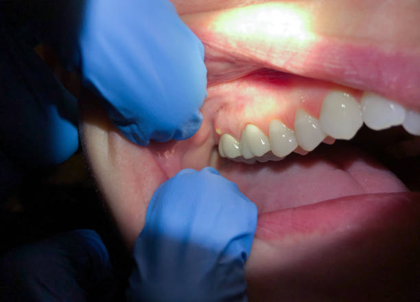 Best Emergency Dental Services for Seniors in Bling, AR